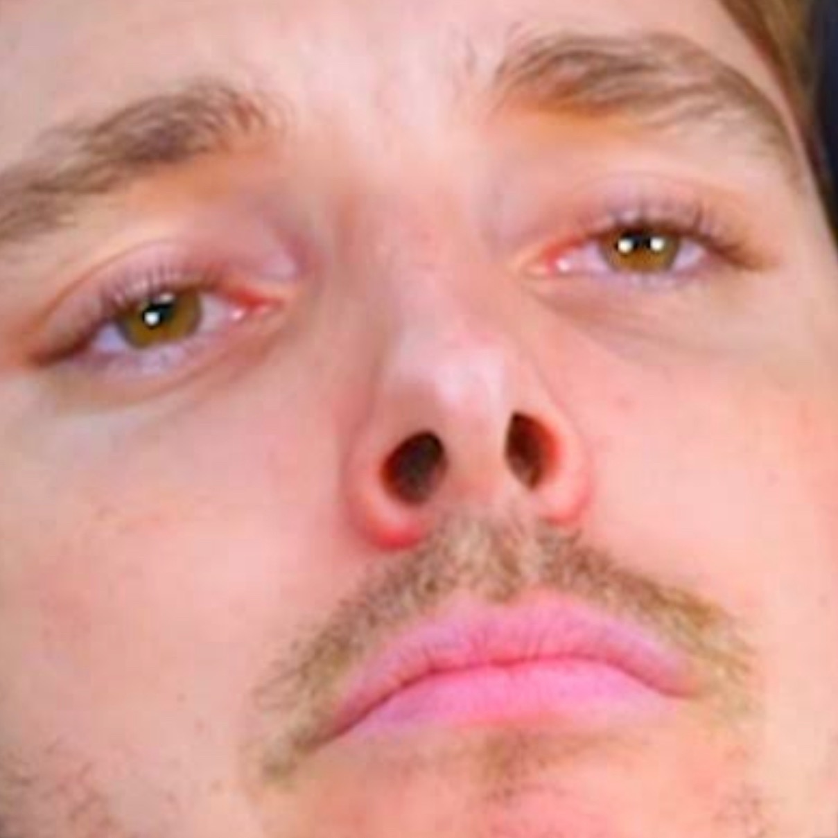 LazarBeam  lazarbeam