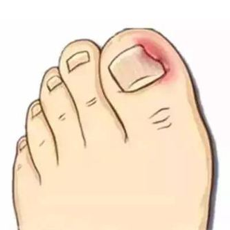 baida3 pedicurist0