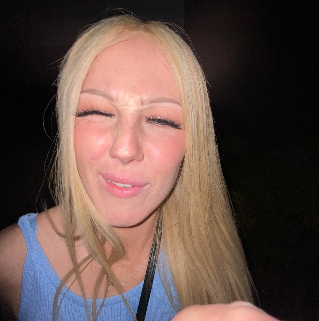 olivia archer xoxo.baldgirl