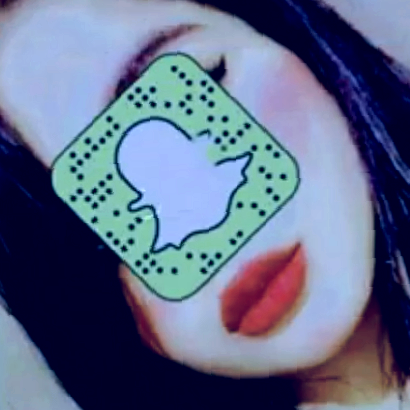 توته المجروحه 🙁💔 user353389908