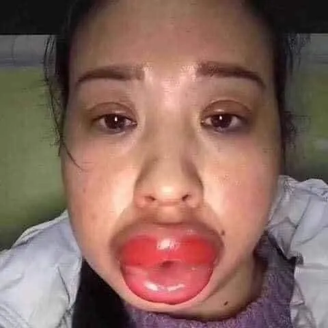 @93binhhphuocc